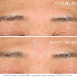 CAPTURE TOTAL HYALUSHOTCorrector de arrugas existentes y primeros signos de arrugas