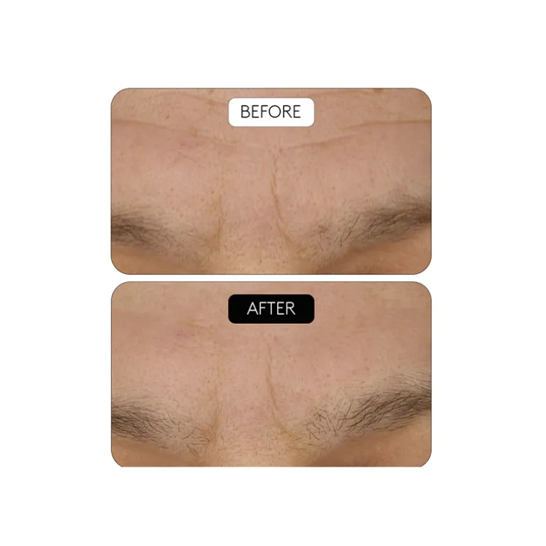 Clinical Beauty Filler Duo