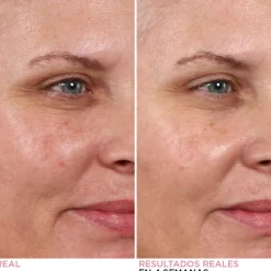 HELLO RESULTS BIPHASE PEEL 30ML