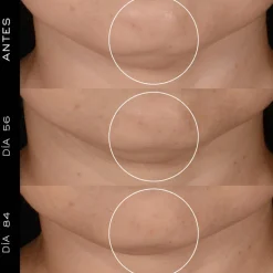 RÉNERGIE H.P.N. 300 -PEPTIDE CREAM CREMA REGENERADORA ANTI-EDAD EDICIÓN LIMITADA